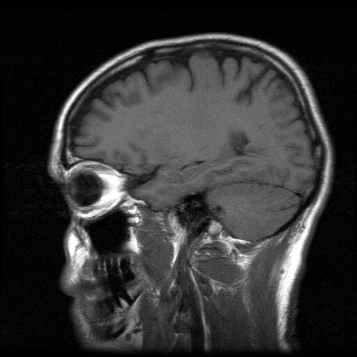 Brain MRI - email marketing images